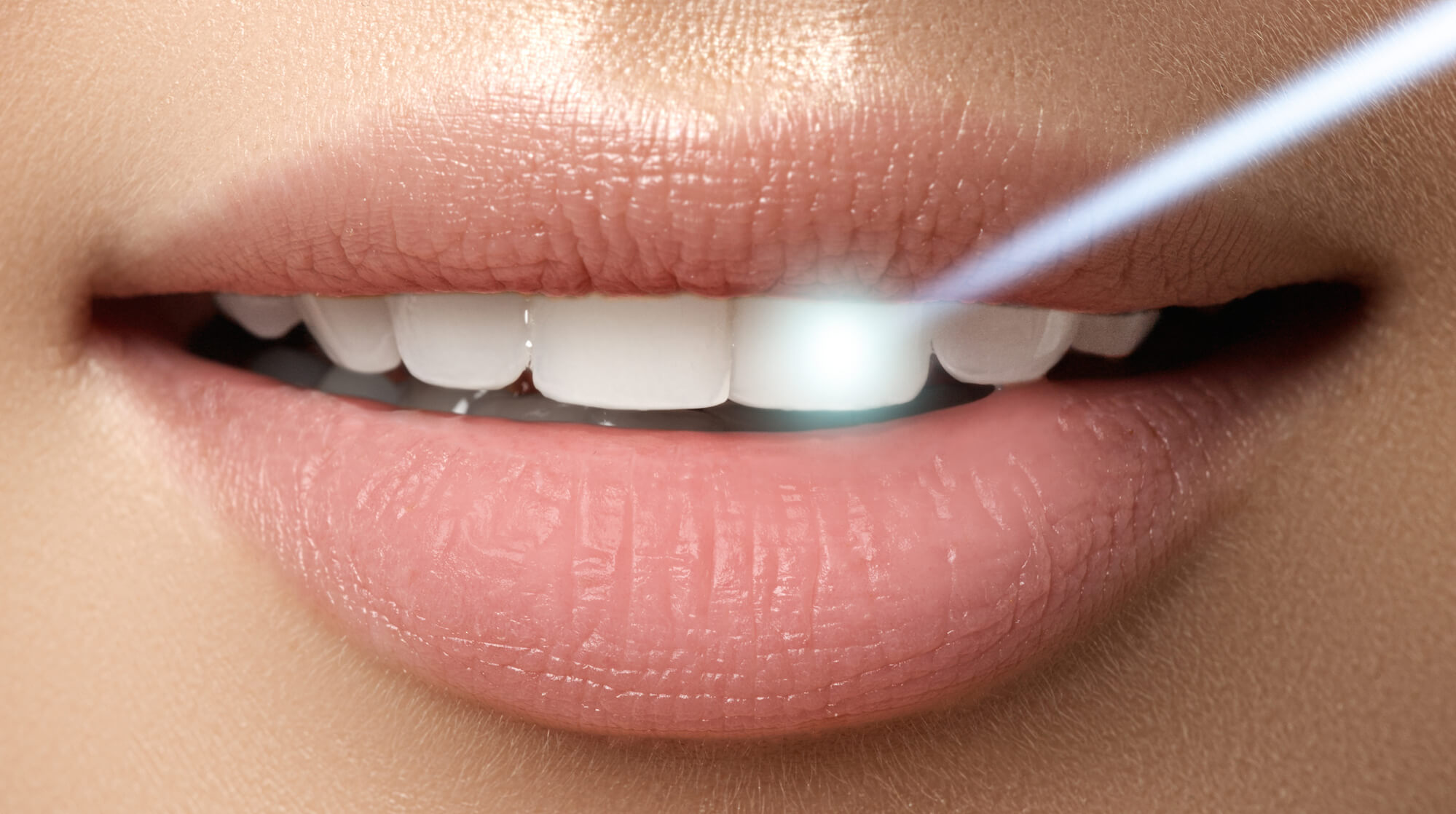 What Is Laser Dentistry and How Can It Help Me?