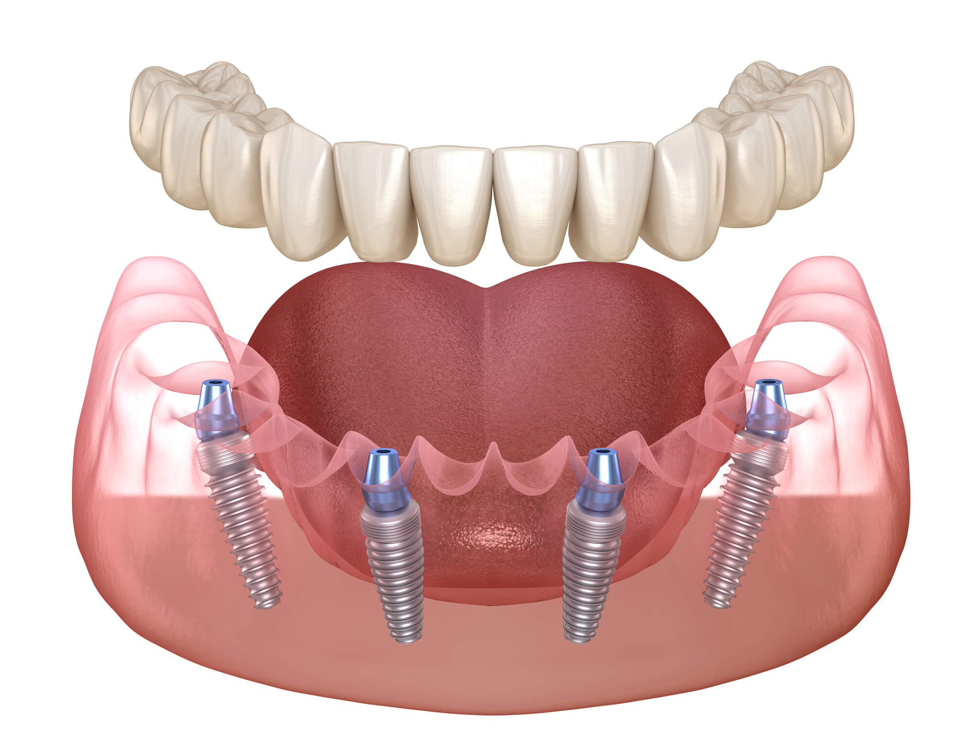 Jupiter Dentistry