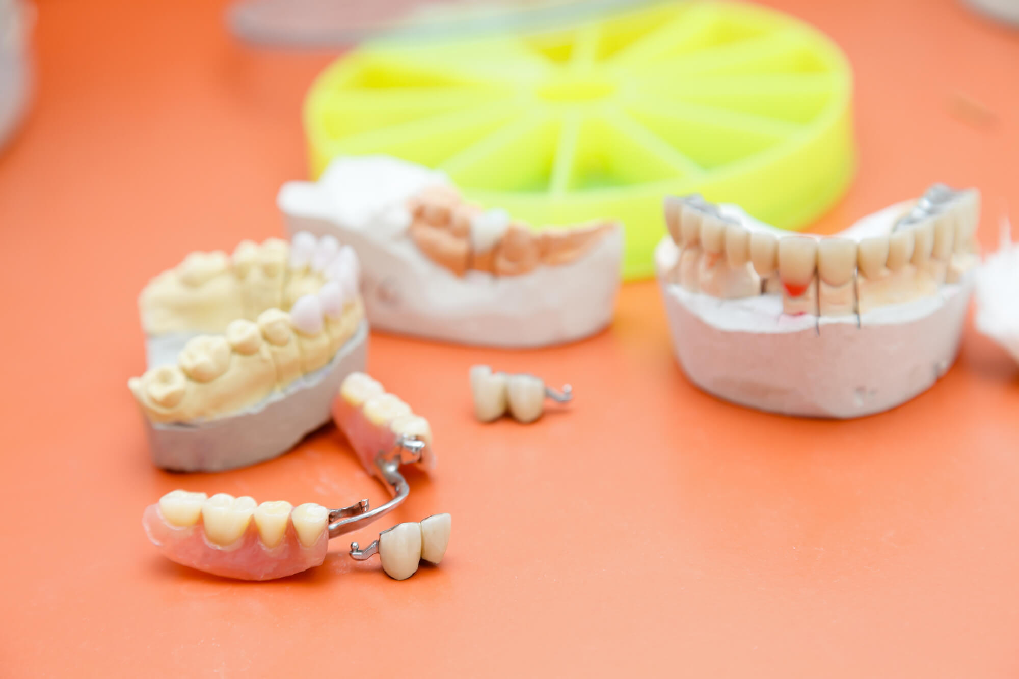 How to Clean Dental Bridges?