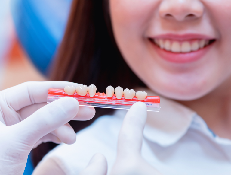 Dental Crowns