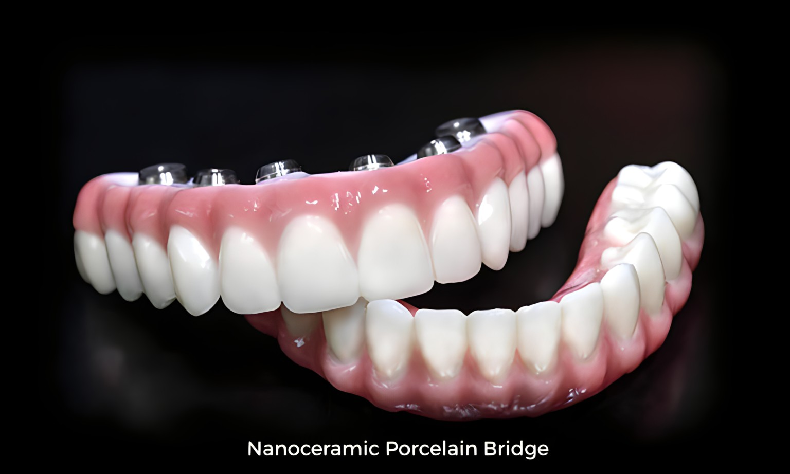 Dentures made from nanoceramic materials.