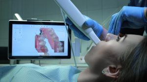 trios scanner with digital dental impression